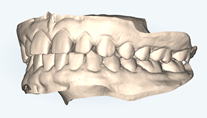 Scanned 3D image of teeth