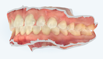 Scanned 3D image of teeth